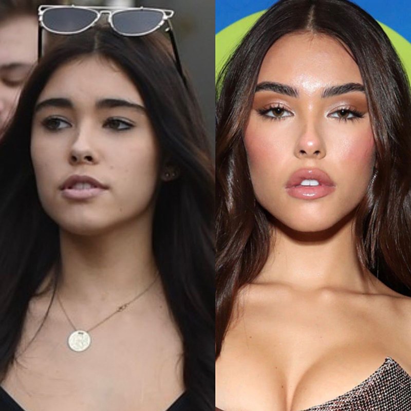 Madison Beer Plastic Surgery Before And After Pics Revealed