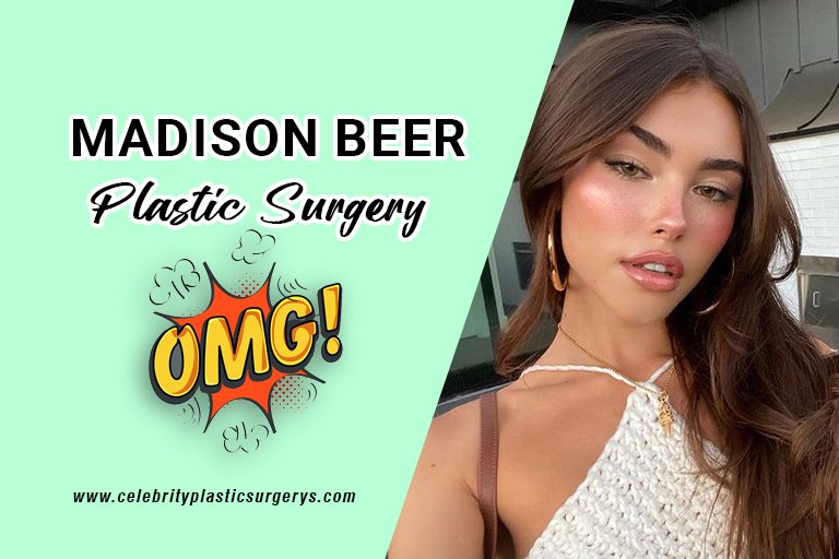 madison-before-and-after-surgery