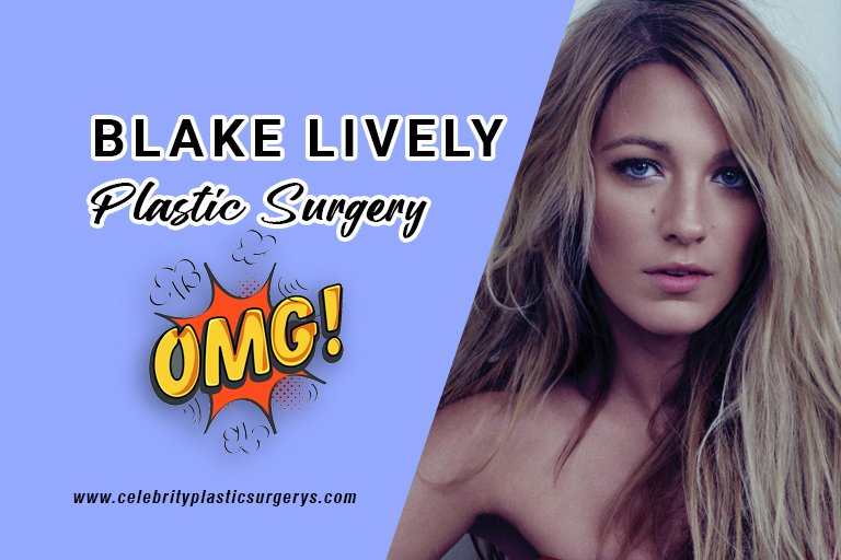 Blake-Lively-plastic-surgery-before-and-after