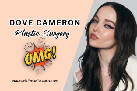 Dove-Cameron-plastic-surgery-before-and-after-pic