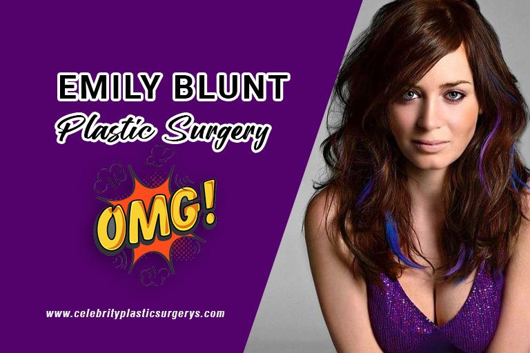 Emily-Blunt-plastic-surgery-before-and-after