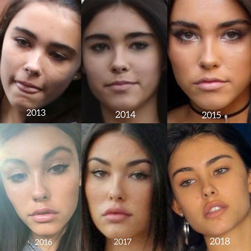 madison beer before and after