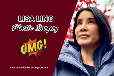 lisa-ling-surgery-pic