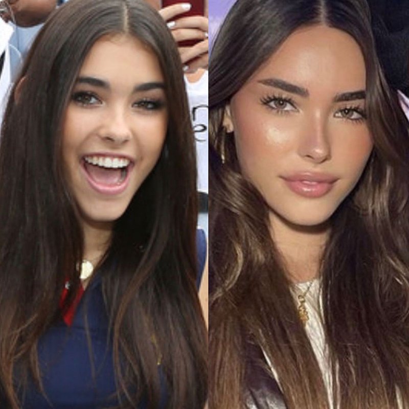 madison-beer-without-plastic-surgery