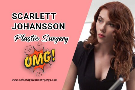 scarlett-johansson-surgery